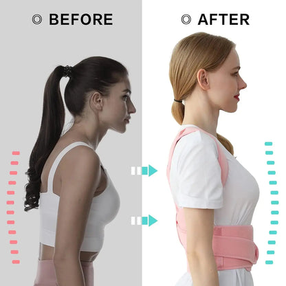 Adjustable Posture Corrector for Womens and Mens - BeautiMass