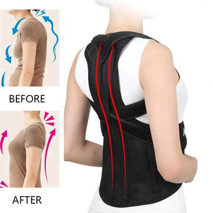 Back Brace Posture Corrector Women Men Improve Posture - BeautiMass