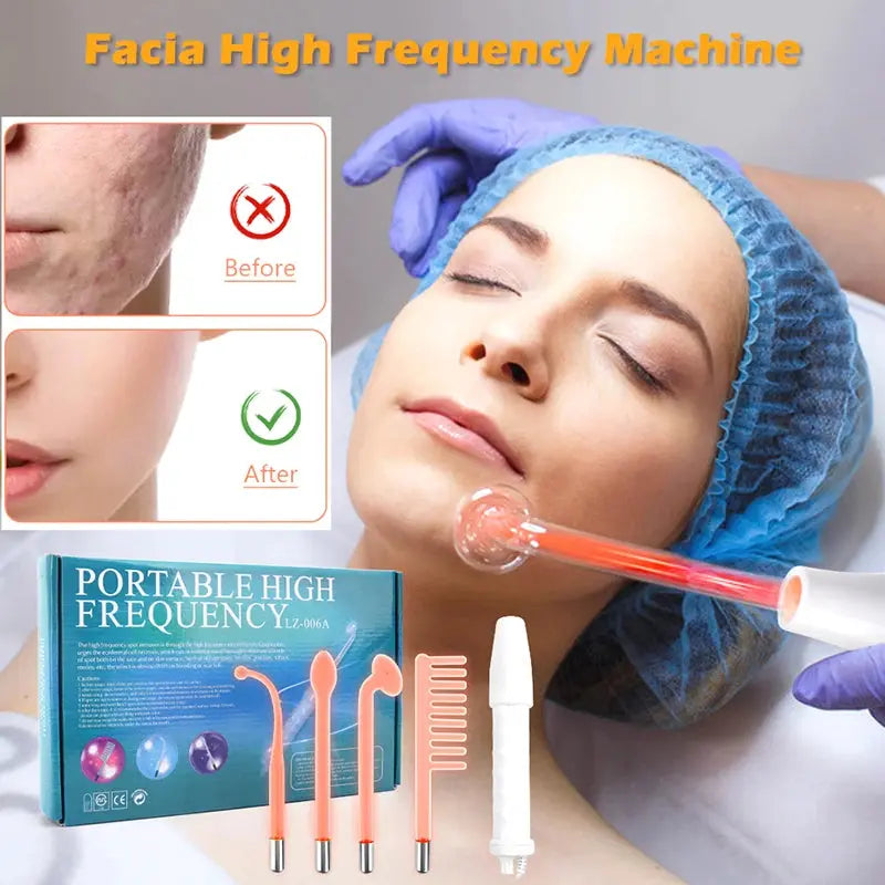 Portable Electrode High Frequency Facial Beauty - BeautiMass