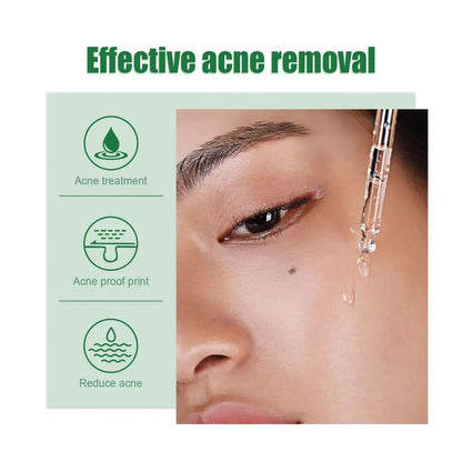 Acne Treatment Facial Serum Pore Shrinking Skin Care - BeautiMass