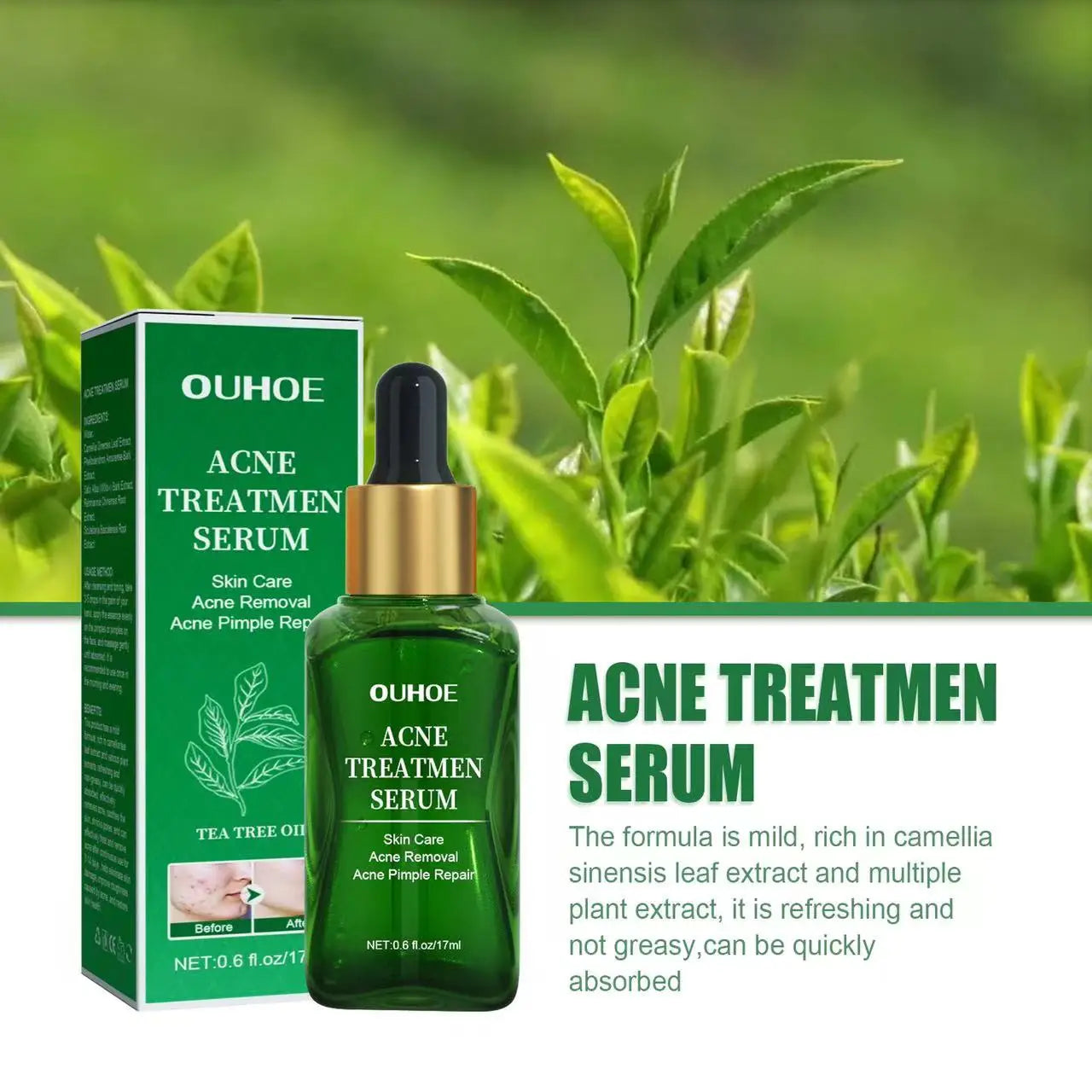 Acne Treatment Facial Serum Pore Shrinking Skin Care - BeautiMass