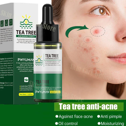 Tea Tree Acne Removal Oil Shrink Pore Blackheads Facial Cleaning - BeautiMass