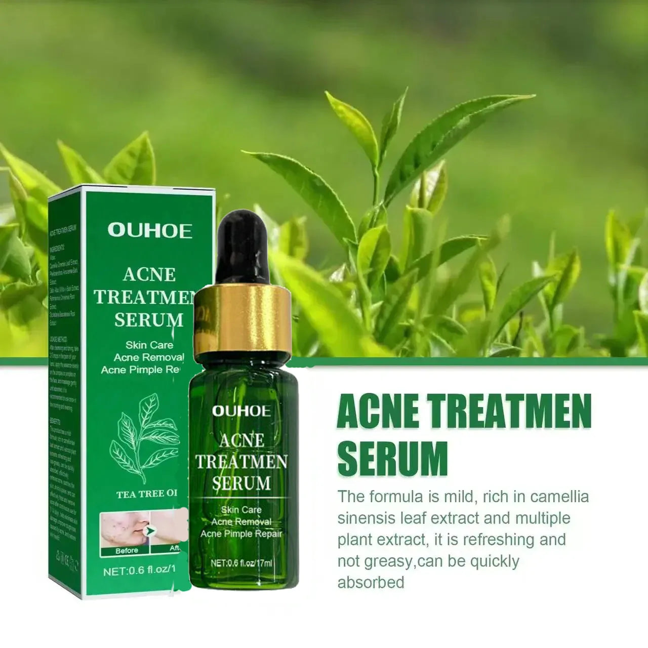 Acne Treatment Facial Serum Pore Shrinking Skin Care - BeautiMass